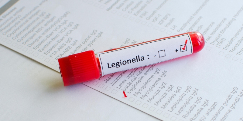 legionella