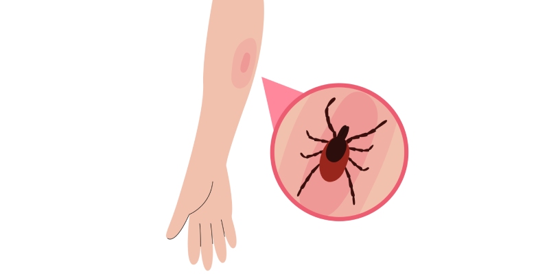 enfermedades transmitidas por garrapatas