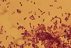 streptococcus lactis