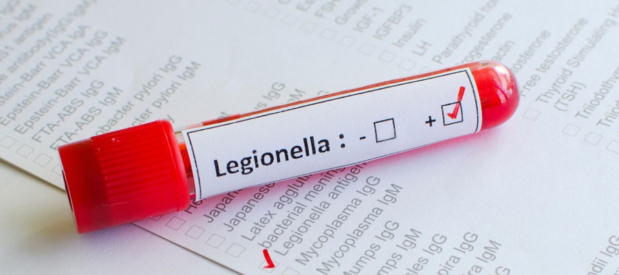 legionella