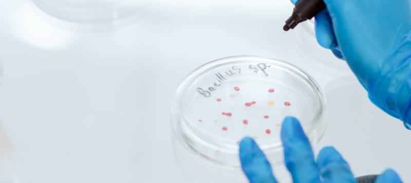 seguridad alimentaria