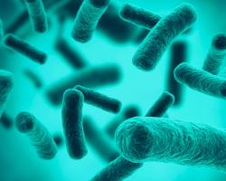 legionella