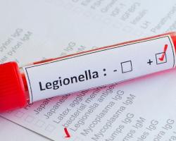 legionella