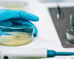 seguridad alimentaria