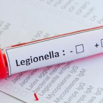 legionella